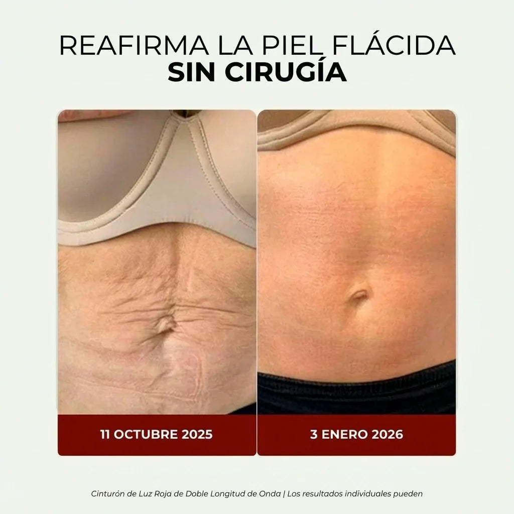 Faja de Luz Roja para Reafirmar el Abdomen y Recuperar la Confianza
