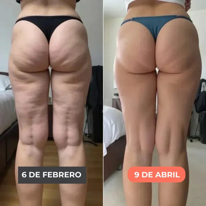 Legging 3D VYTAL – Redefine tu silueta sin esfuerzo