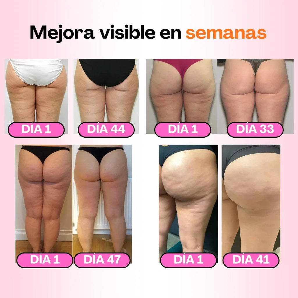 Mallas Anticelulíticas - Redefine tu silueta sin esfuerzo (Pack de 3)