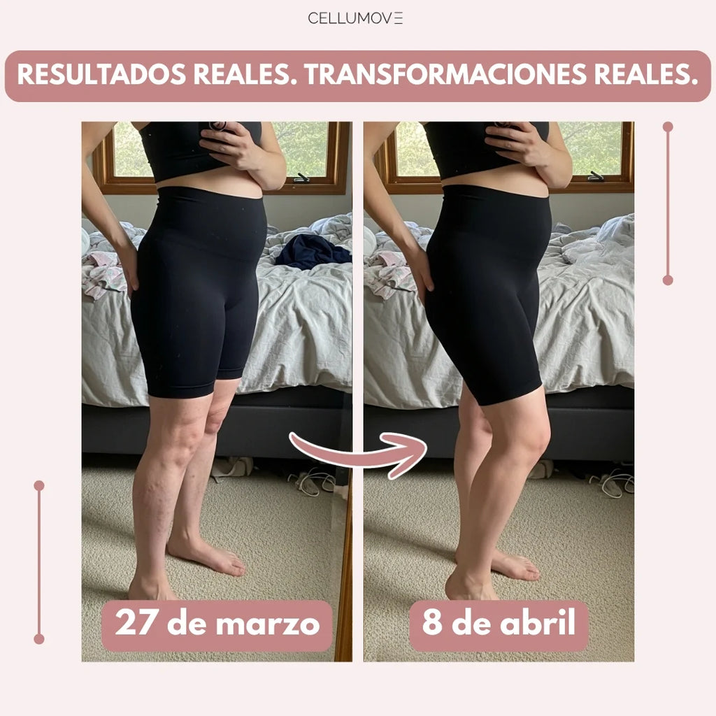 Leggings Cellumove 3D – Edema posparto