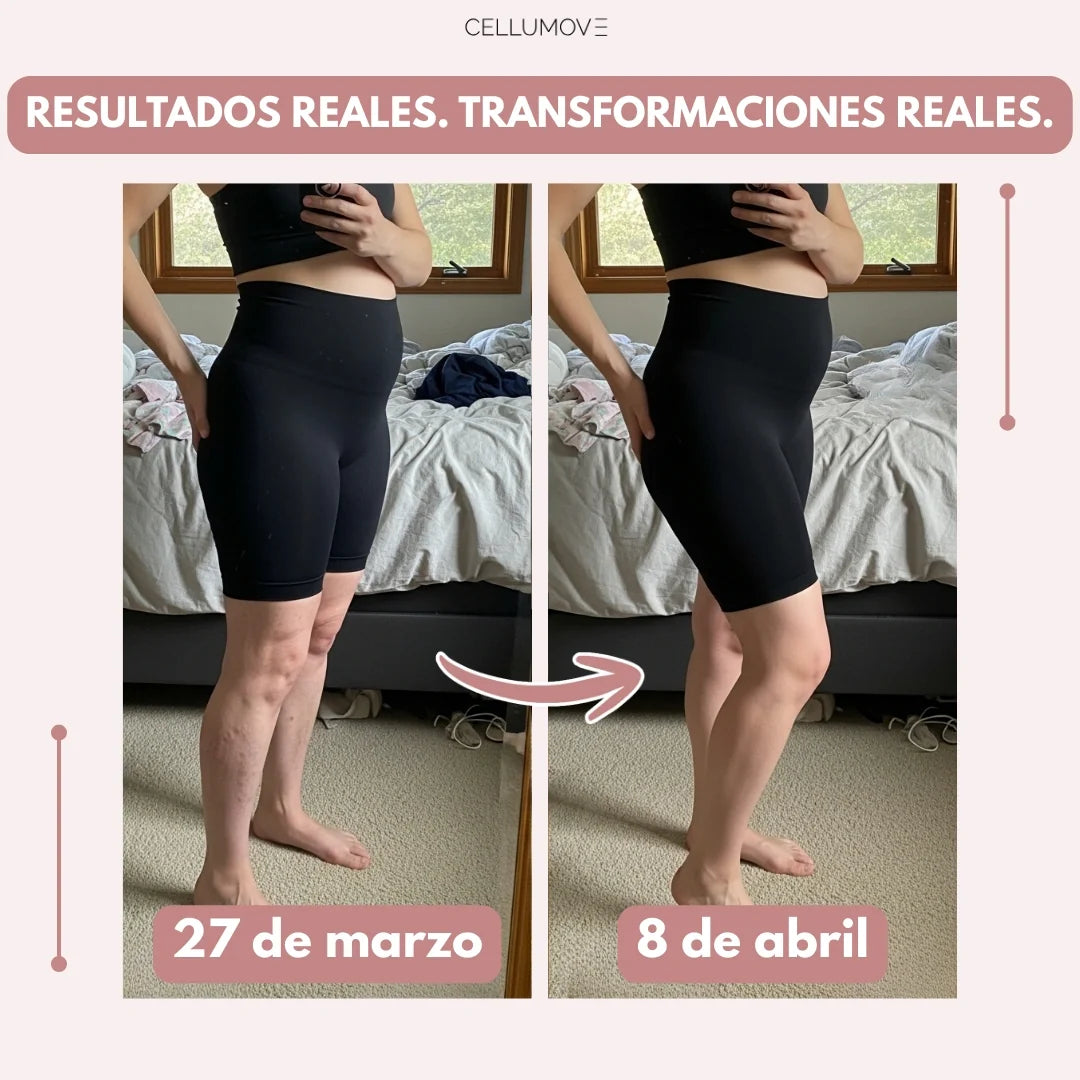 Leggings Cellumove 3D – Edema posparto