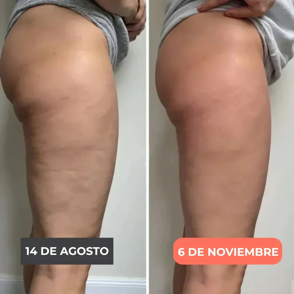 Legging 3D Cellumove – Redefine tu silueta sin esfuerzo