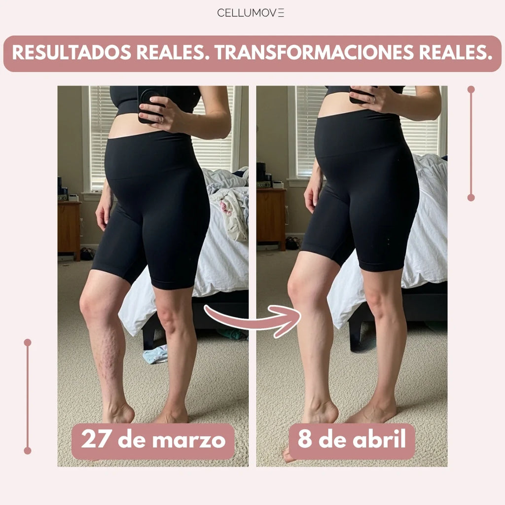Leggings Cellumove 3D – Edema posparto