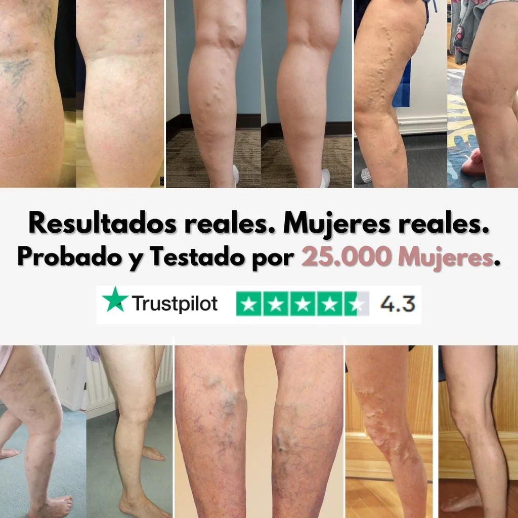 Cellumove 3D Legging: alivia y previene las varices de forma natural.