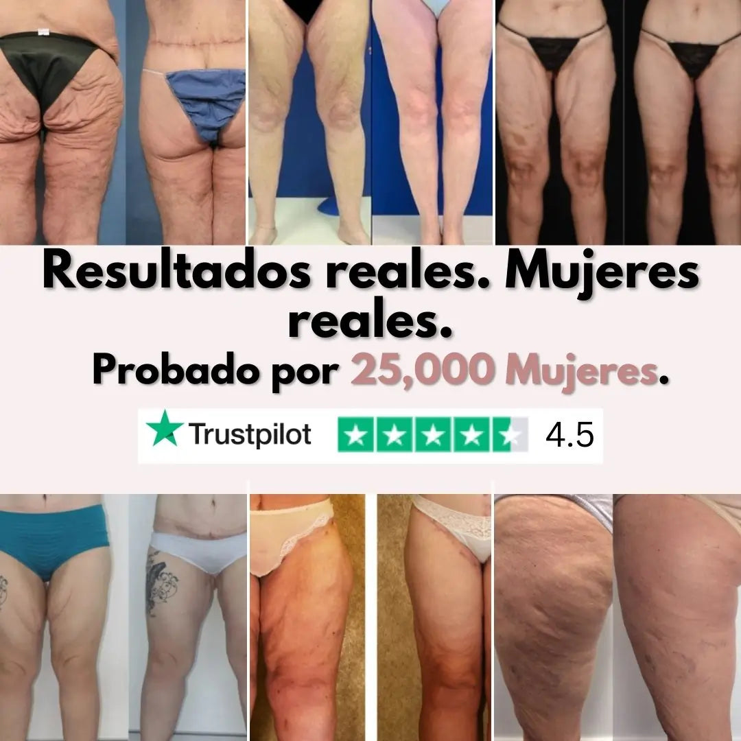 Piernas más firmes y suaves en 14 días — para mujeres cansadas de que la piel flácida las detenga (modelo mayor)