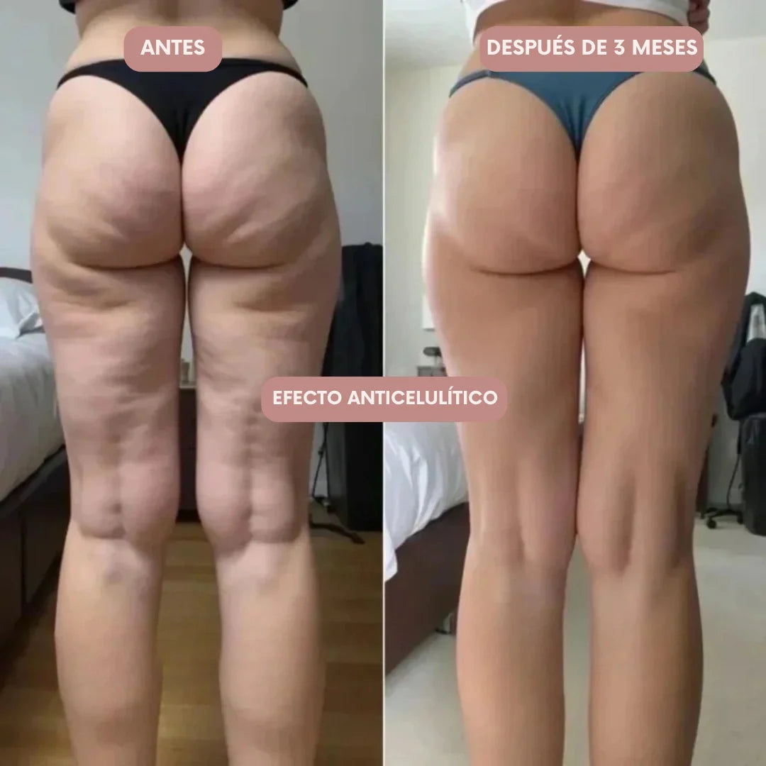 Legging 3D Cellumove – Redefine tu silueta sin esfuerzo
