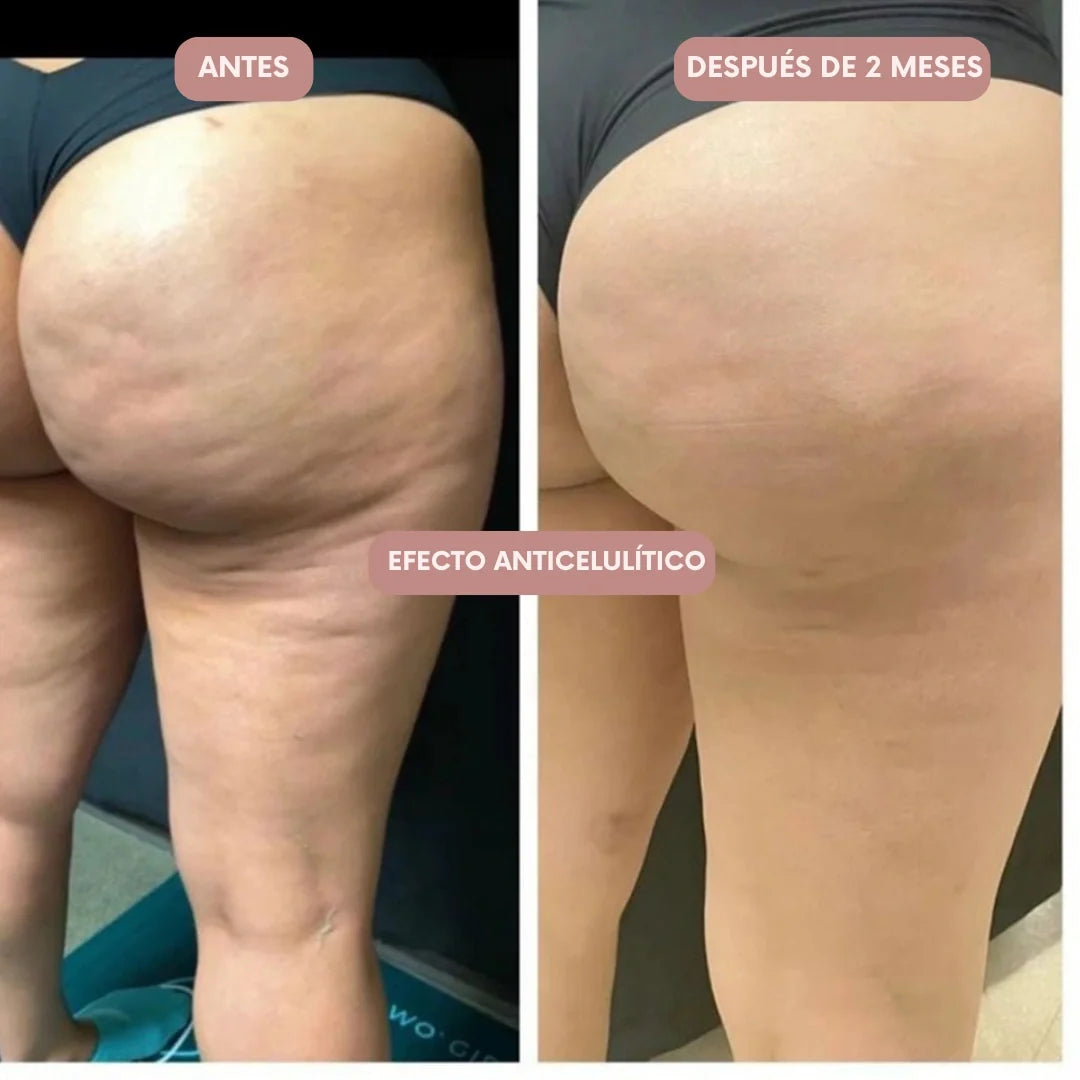 Legging 3D Cellumove – Redefine tu silueta sin esfuerzo