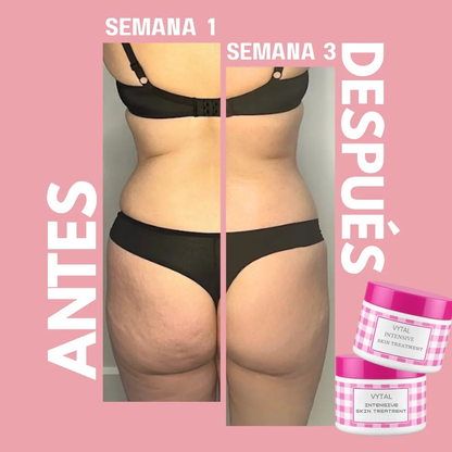 Crema Multifuncional VYTAL 300g