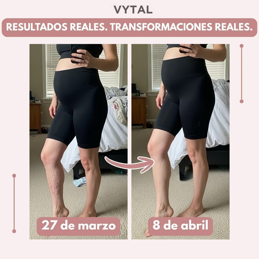 Las mallas anticelulíticas para mujeres que lo han probado todo: resultados visibles en 14 días
